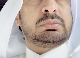 ماذا لو سرقونا ..؟