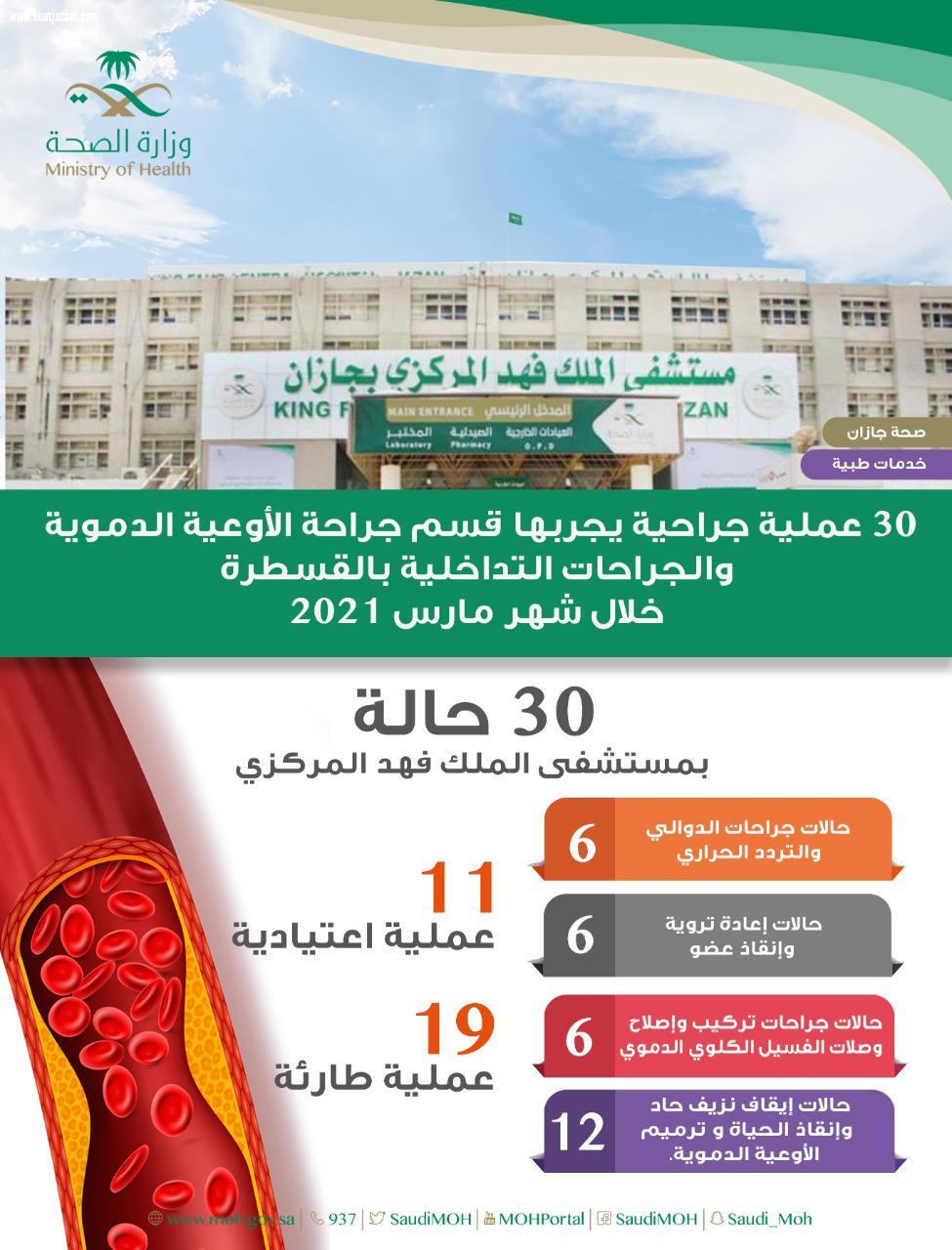 30 عملية جراحية يجريها قسم جراحة الأوعية الدموية والجراحات التداخلية بالقسطرة بمركزي جازان خلال شهر مارس من العام 2021